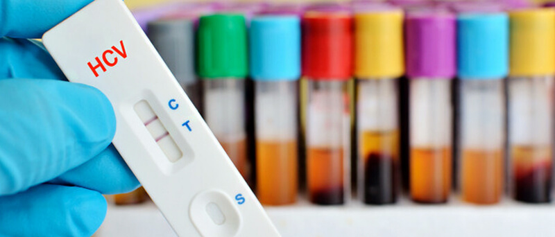 Image representing hepatitis testing procedures or a liver health graphic