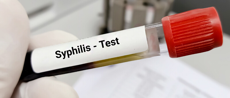 Image representing syphilis testing procedures or health screening